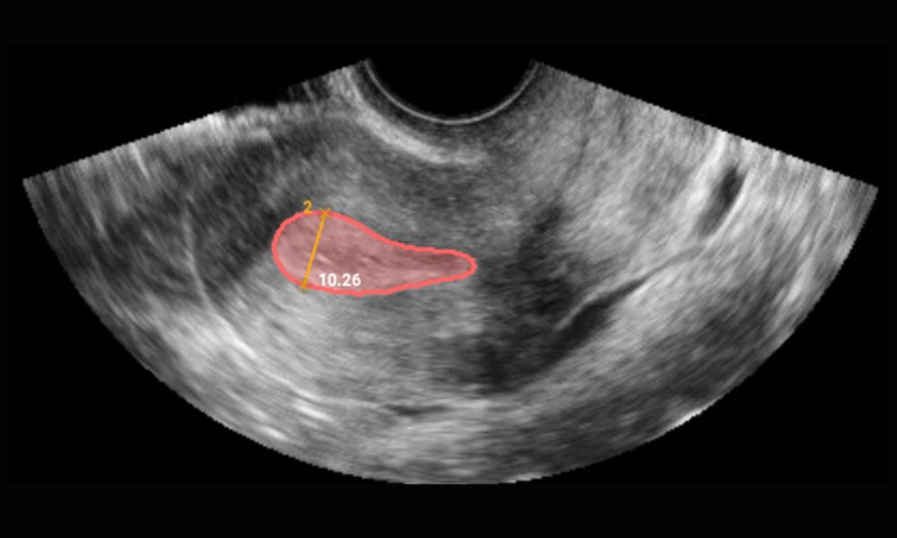 endoscan-image