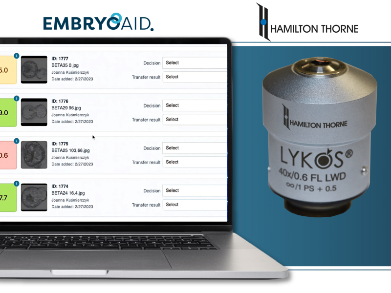 A laptop with screenshot of EMBRYOAID software and Hamiltonb Lykos lens